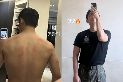 “Wounds of glory” V (Kim Taehyung) flaunts scars and bulked-up body from intensive military training as a Special Forces (SDT) soldier